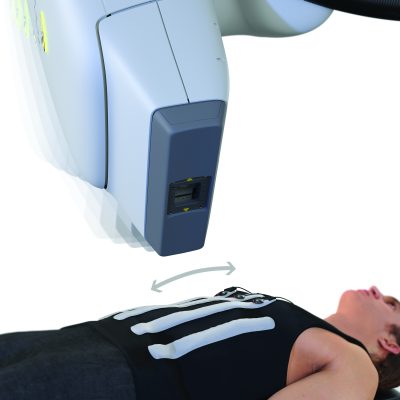 synchvest-linac-mvmt